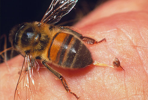 Honey Bee Stings: The Truths and Myths